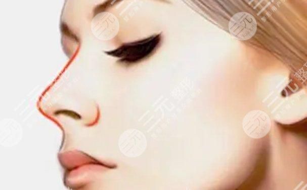 整容鼻子能否保持一輩子？深度解析鼻子整容的持久性，深度解析，鼻子整容的持久性——能否保持一輩子？
