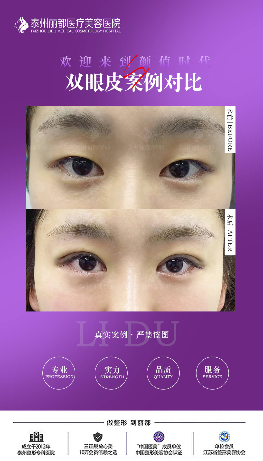 尋找附近割雙眼皮的最佳醫(yī)院，專(zhuān)業(yè)、信譽(yù)與品質(zhì)并重，尋找附近專(zhuān)業(yè)信譽(yù)與品質(zhì)并重的割雙眼皮最佳醫(yī)院