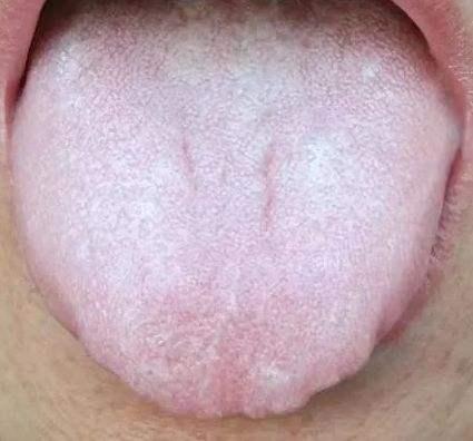 喉嚨感覺有東西堵著是怎么回事，解析癥狀與原因，喉嚨感覺有東西堵著的原因及癥狀解析