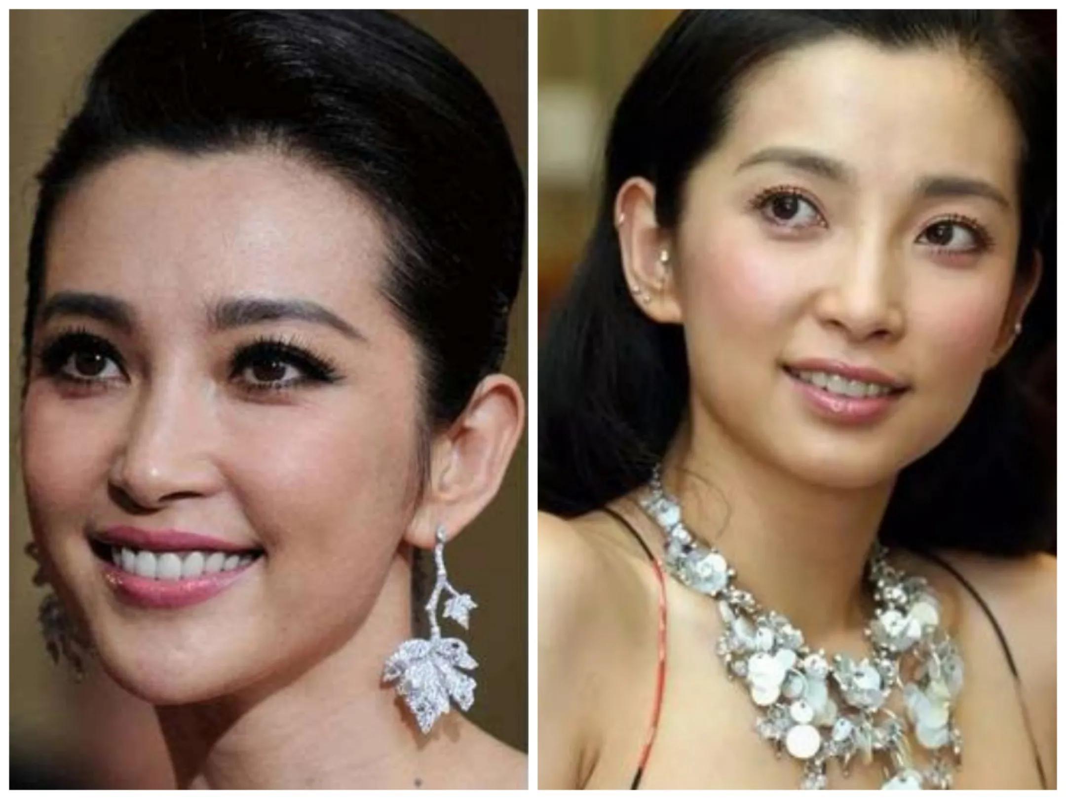 整容最嚴(yán)重的女星，探究過度整容背后的故事與挑戰(zhàn)，探究女星過度整容背后的故事與挑戰(zhàn)，整容最嚴(yán)重的女星揭秘