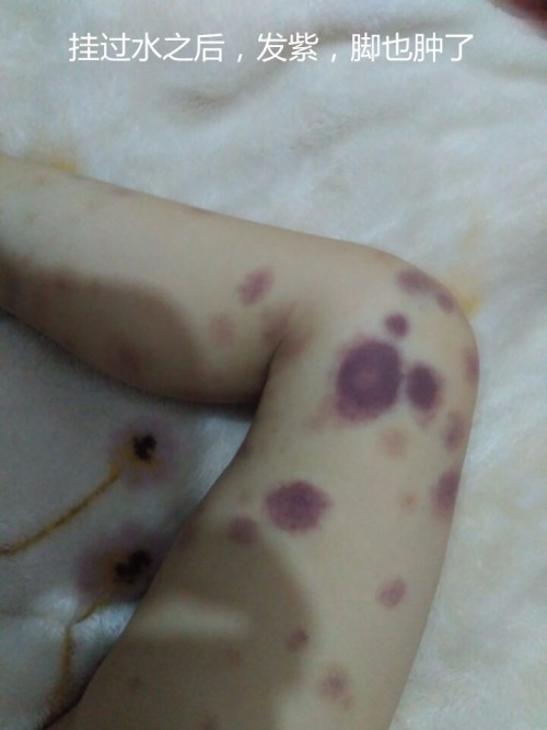 圖片解析
