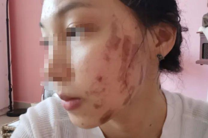 光子嫩膚與衰老，真相揭秘，你老得快嗎？，揭秘光子嫩膚與衰老真相，你了解衰老背后的秘密嗎？