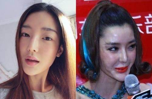 因整容而毀容嚇人的明星，背后的故事與反思，整容失敗背后的明星故事與反思，整容變毀容的警示與探究