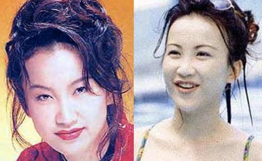 整容后的女明星們，變化背后的故事，女明星整容背后的故事揭秘