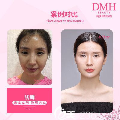 全臉整容費用