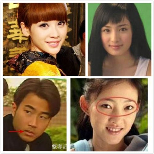 女明星整容，現(xiàn)象背后的深度解析，女明星整容現(xiàn)象背后的深度解析與探討